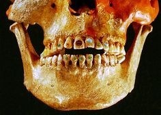Ancient tooth decoration_1