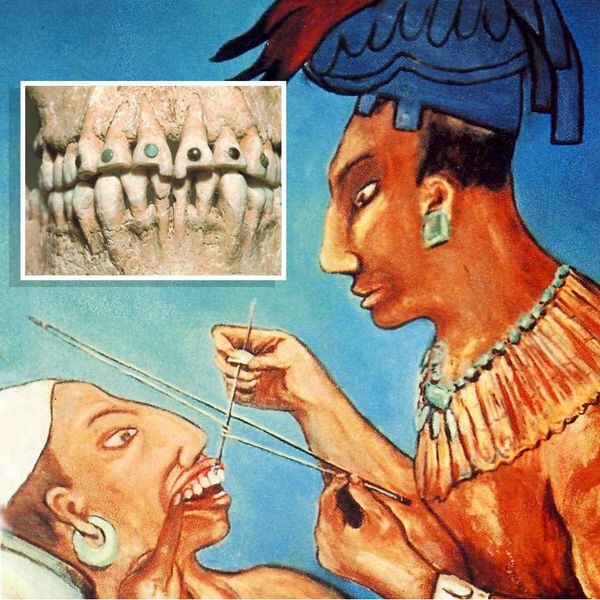 Ancient tooth decoration_2